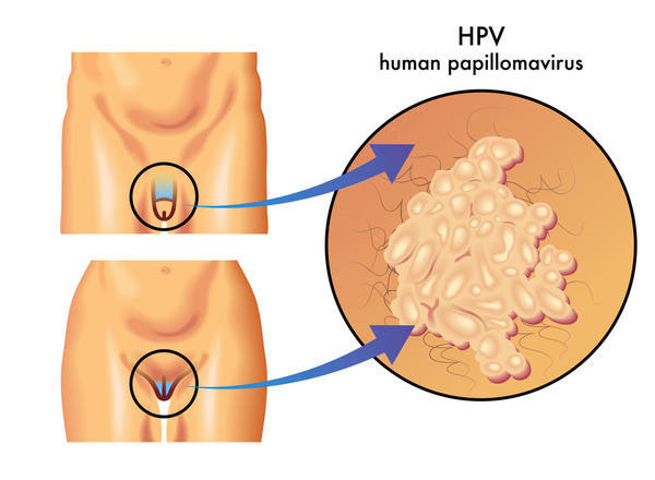 HPV Symptoms