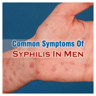 Syphilis Symptoms